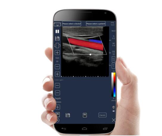麥迪特國產手持式超聲多普勒儀C-scan